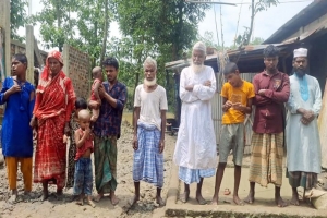  মৌলভীবাজারে ১১ দৃষ্টিপ্রতিবন্ধী মানবিক সহায়তার অপেক্ষায় 